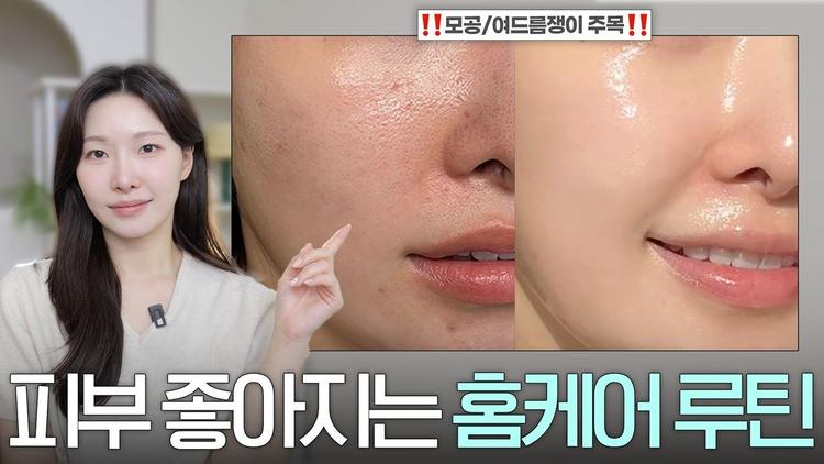 여드름피부라면 '이것' 당장 바꾸세요!!! 피부과꿀템