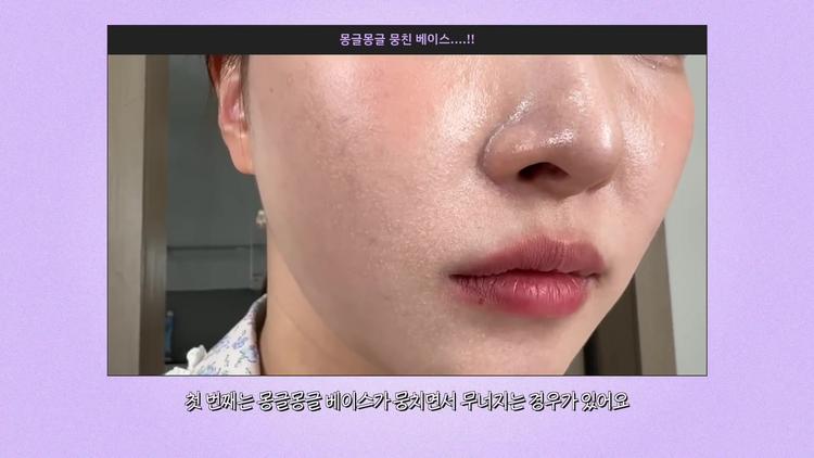 피지로 인한 뭉침 현상, 이렇게 해결하세요 - screenshot_11.jpg